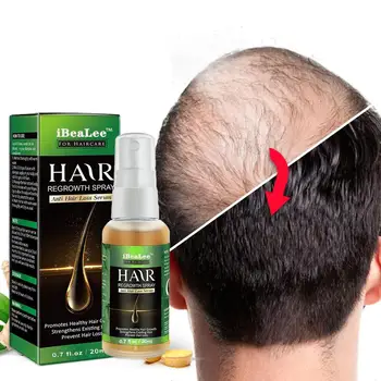 Джинджифил Продукти За Растежа На Косата Бързо Развиващи Косата Етерично Масло Красота, Грижа За Косата Предотврати Загуба На Коса Масло За Лечение На Кожата На Главата За Мъже Жени